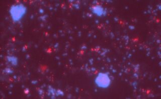 Mikroskopische Aufnahme einer gemeinsamen Kultur der beiden Bakterienarten. Die blaue Färbung zeigt alle Bakterien, bei den roten Punkten handelt es sich um Viren. Sie bringen einige Bakterienzellen zum Platzen, wodurch das Vitamin ins Wasser gelangt.